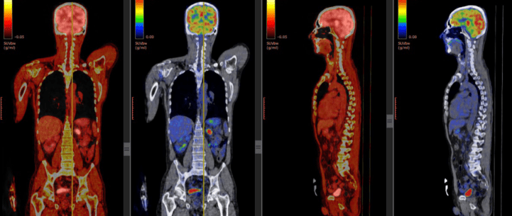 Radiología e imagen molecular