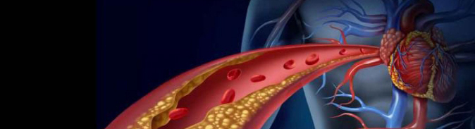 Blood traveling to the heart through arteries with cholesterol