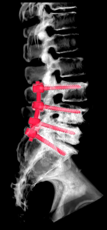 Oncologia