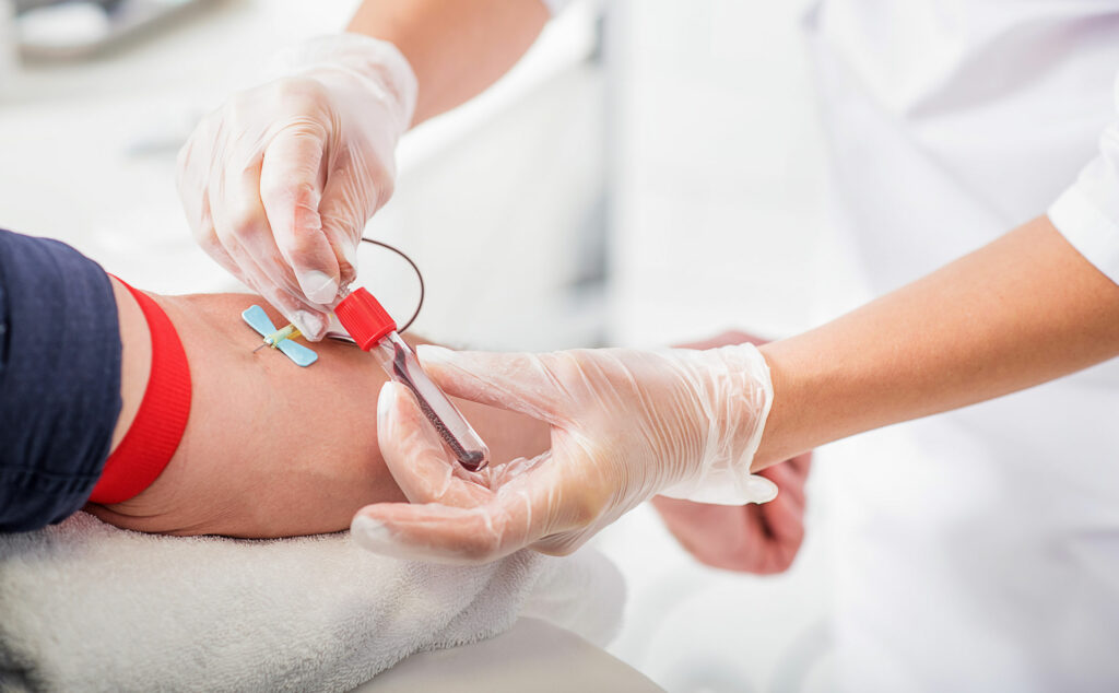 Médico realizando un análisis de sangre