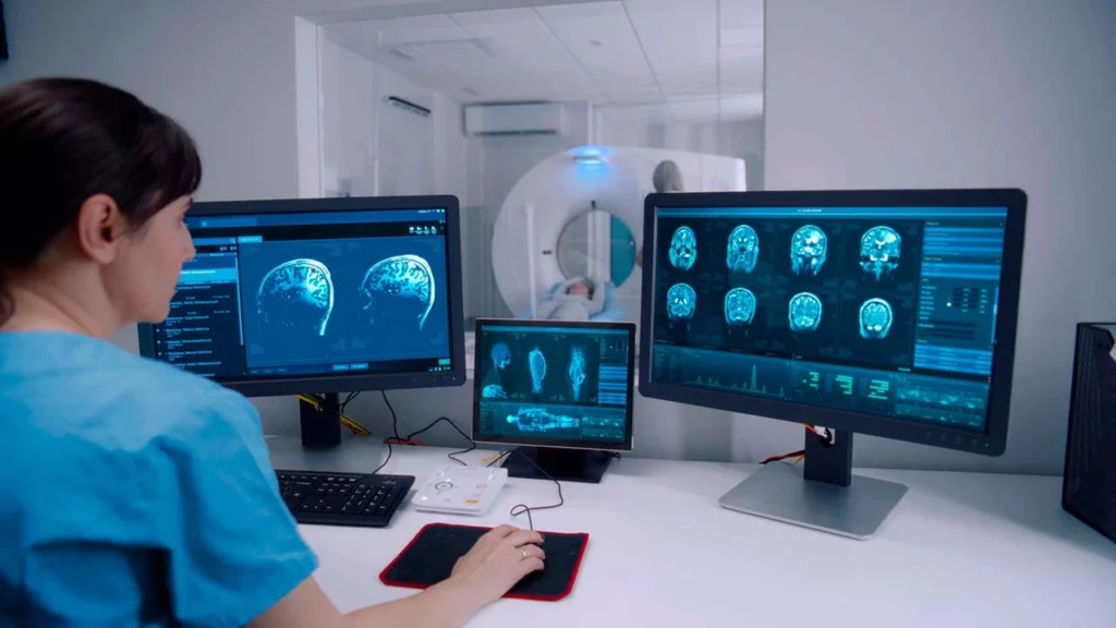 Procedimiento tomográfico de la cabeza, realizado en el área de medicina nuclear.
