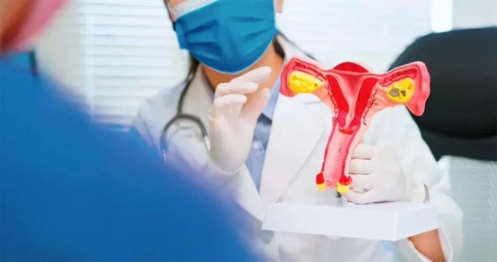 Doctora muestra a paciente un modelo del sistema reproductor femenino para explicar qué es la cervicitis crónica.