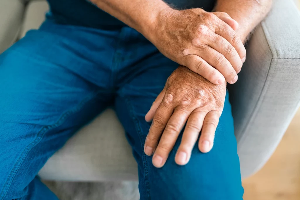 Hombre sentado que presenta síntomas de artritis psoriásica y le molesta la muñeca por esta condición.