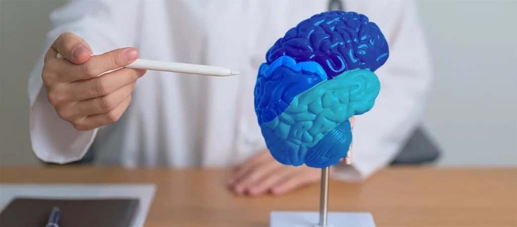 Médico señalando un modelo de cerebro para explicar qué es la terapia endovascular neurológica y cómo se realiza.