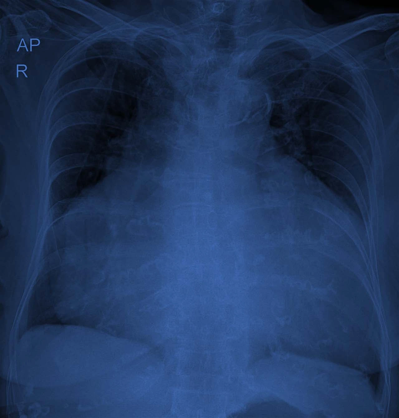 ZYRTEC® Allergy Relief Tablets with 10 mg Cetirizine | ZYRTEC®, image size:1280x1339