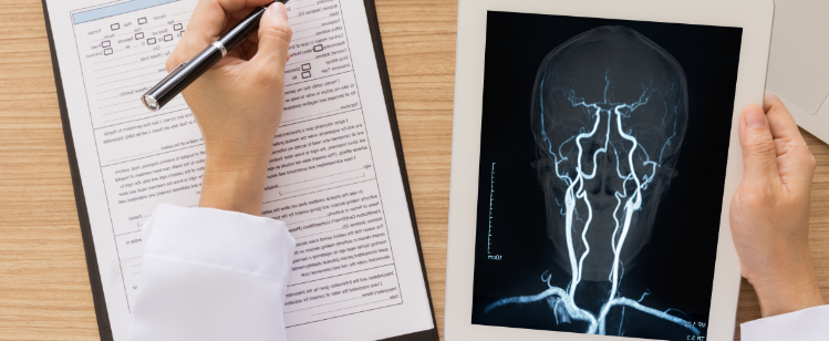 Cerebrovascular diseases - STROKE