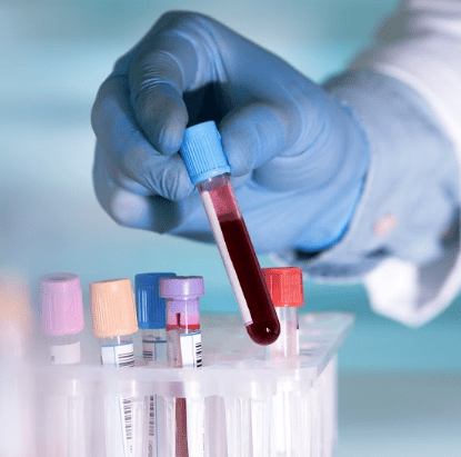 Estudios de Laboratorio | Química Sanguínea