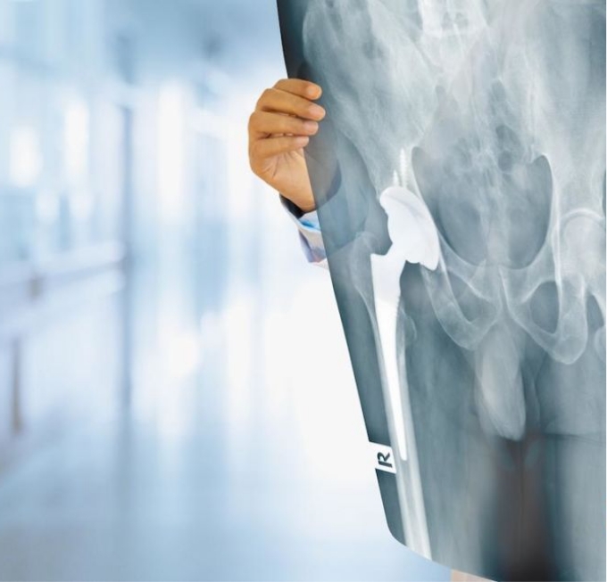 Especialista sosteniendo una radiografía de cadera