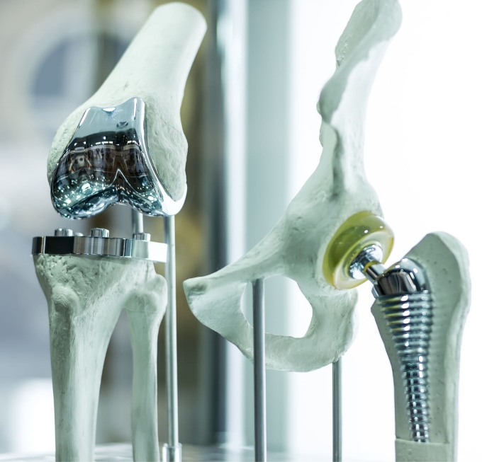 reemplazos-articulares-protesis-rodilla