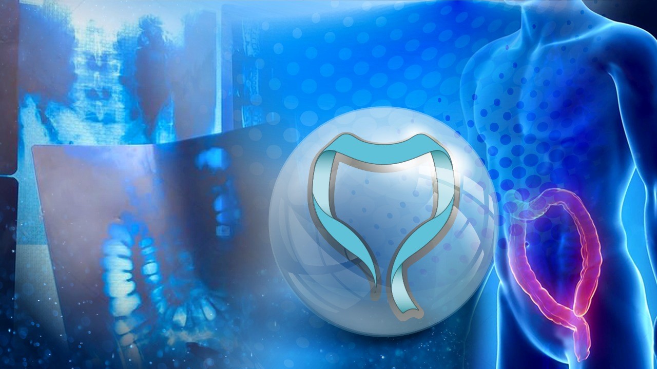 4to Simposio Internacional de Cáncer Colorrectal