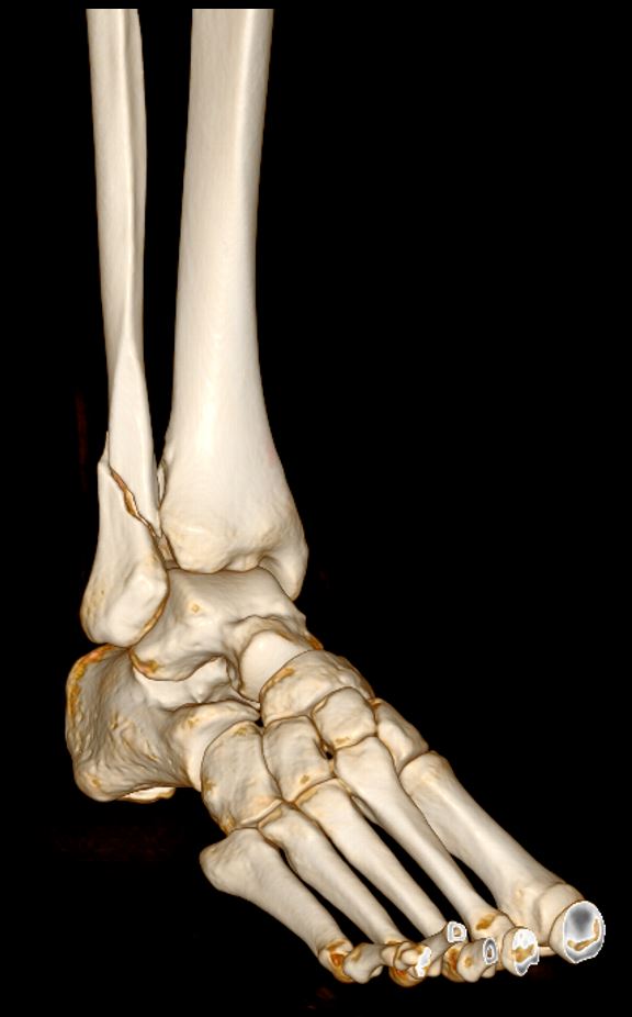 Vista de ortopedia