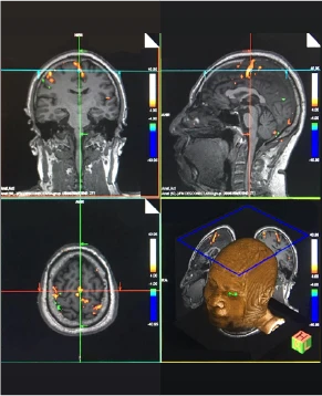 Diagnostico en diferentes vistas