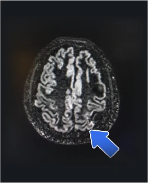 Diagnostico
