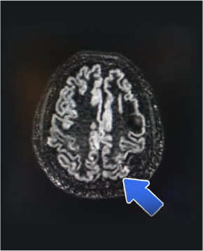 Diagnostico