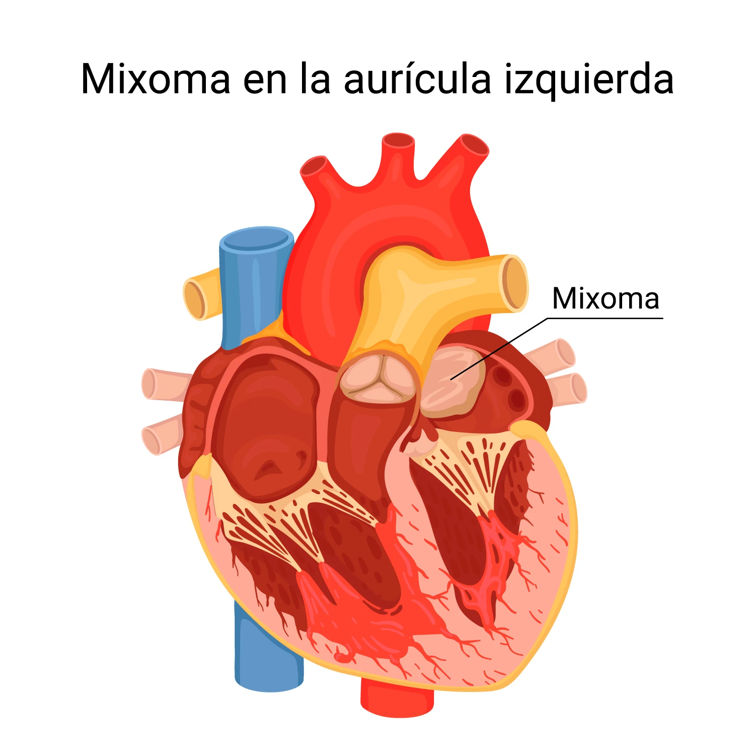 Diagrama del corazón Diagrama del corazón