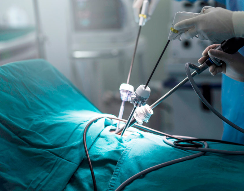 Laparoscopía: la nueva era de la cirugía