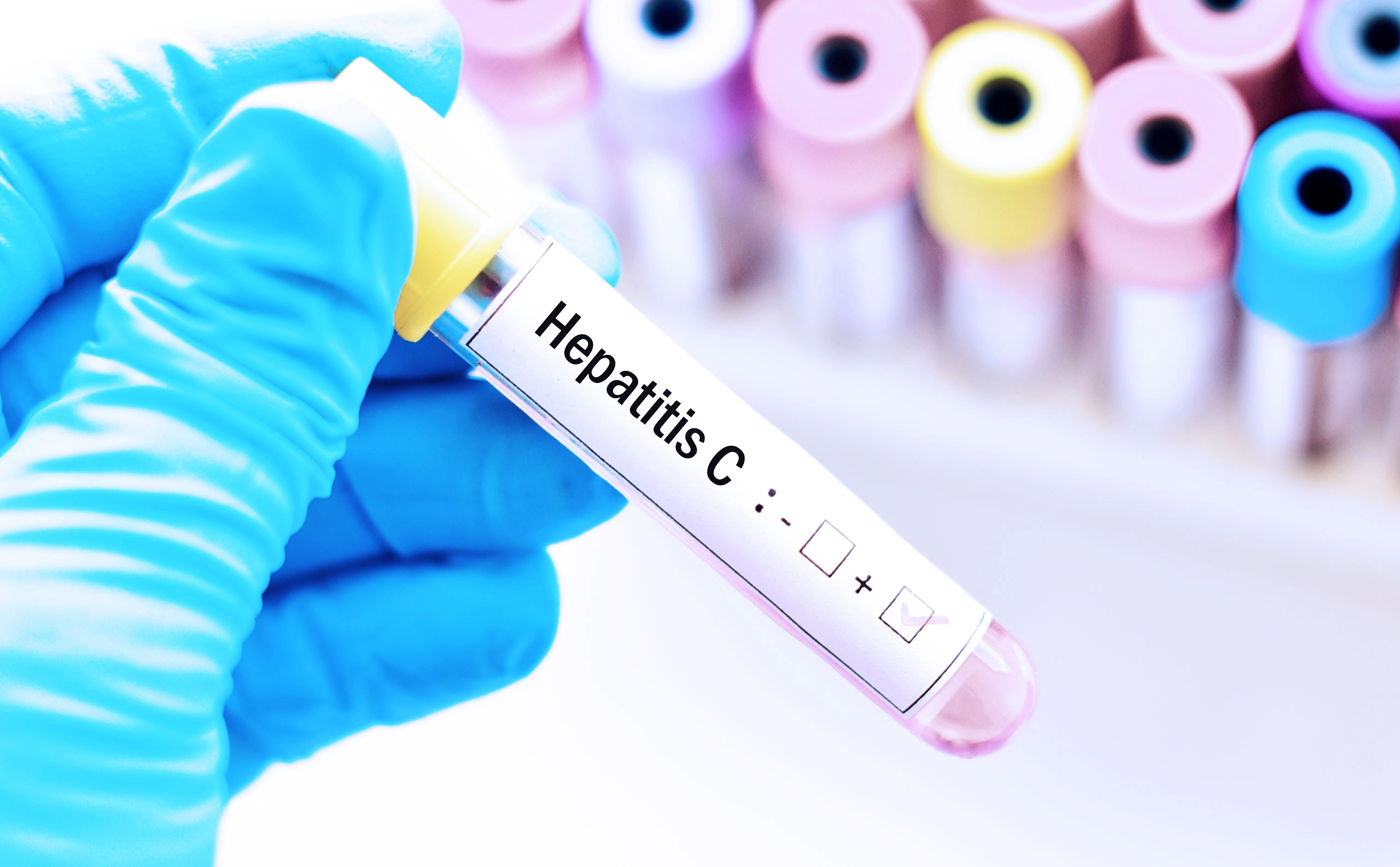 ¿Cómo se contagia la hepatitis C?
