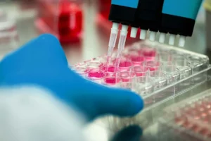 Prueba de placa realizada para su análisis mediante la genética médica.
