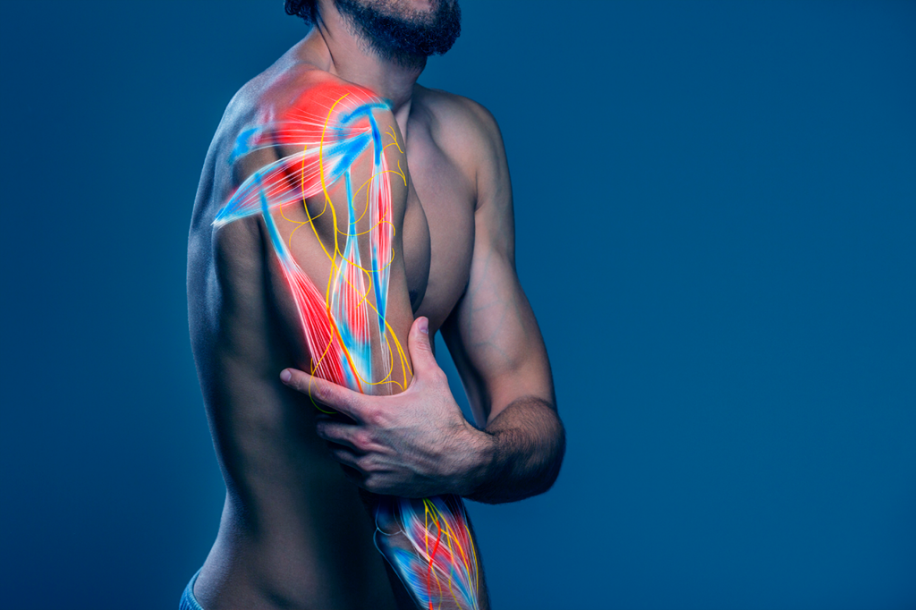 Image of a man showing the nerves of the brachial plexus and the musculature of the arm.