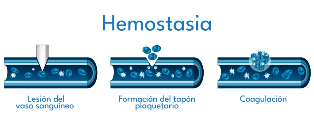 Qué es hemostasia