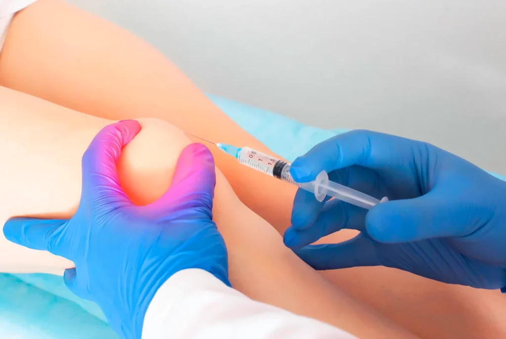 Médico realizando una infiltración de ácido hialurónico en la rodilla de una paciente.