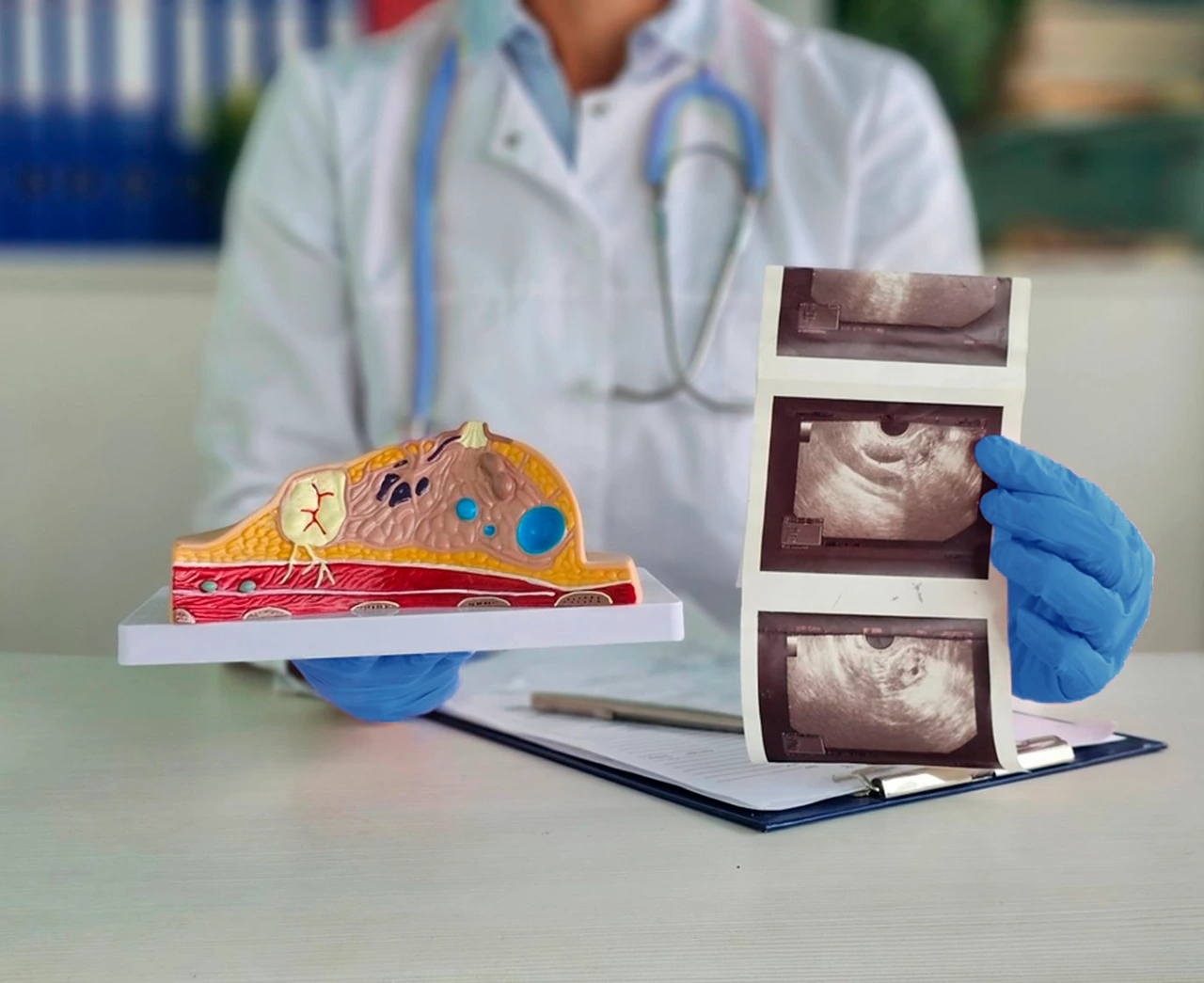 Webinar: Cáncer de mama en los extremos de la vida
