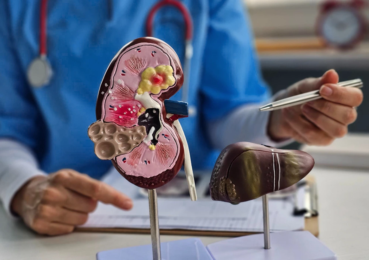 Webinar: ¿Cómo afecta el cáncer a tus riñones?