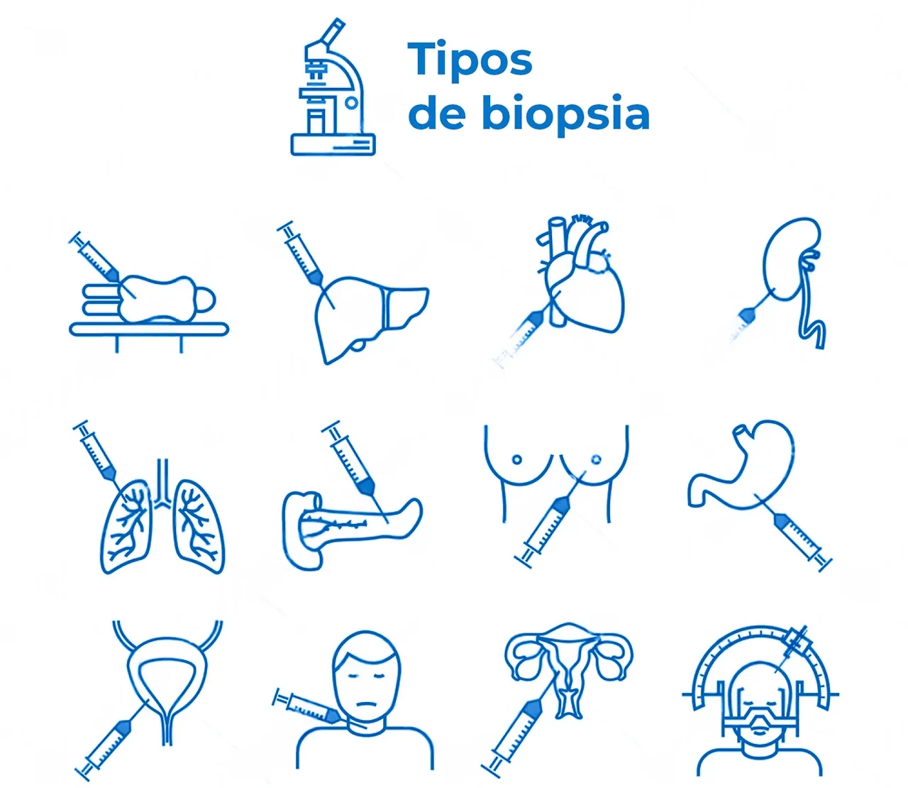 Tipos de biopsia Íconos de los diferentes tipos de biopsia que se pueden realizar, que forman parte del proceso de cómo detectar el cáncer.