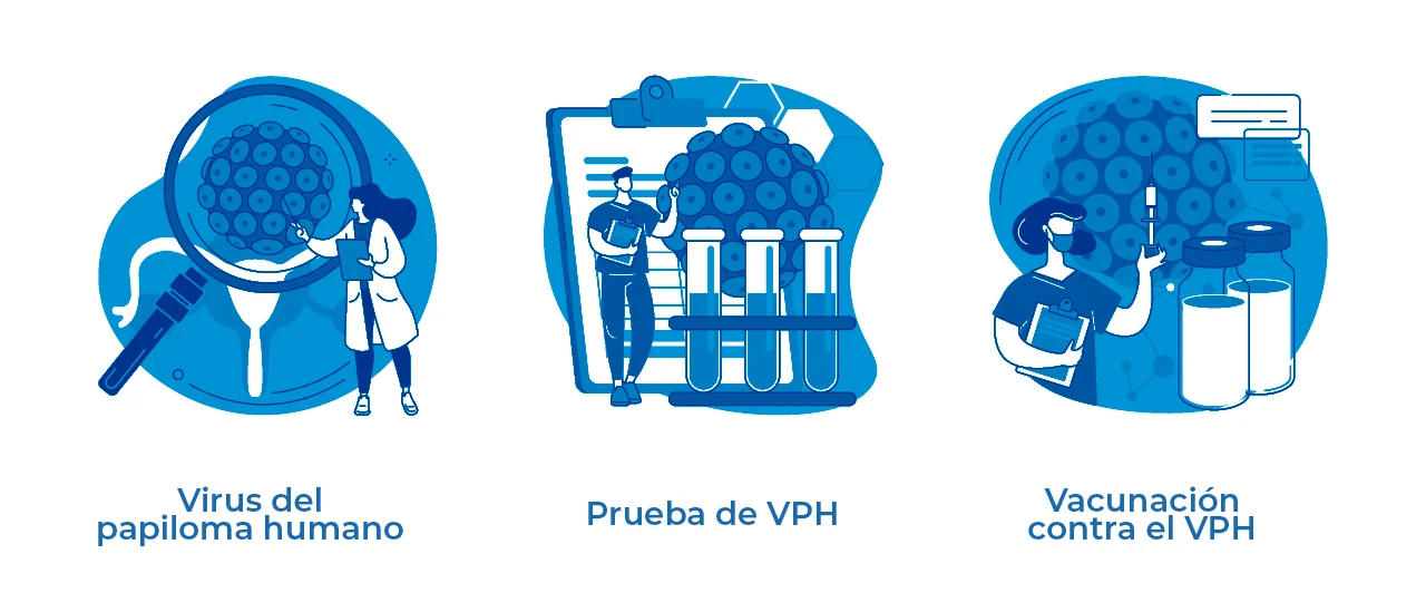Ilustración que representa un método de cómo detectar el cáncer a través del test de VPH. Ilustración que representa un método de cómo detectar el cáncer a través del test de VPH.