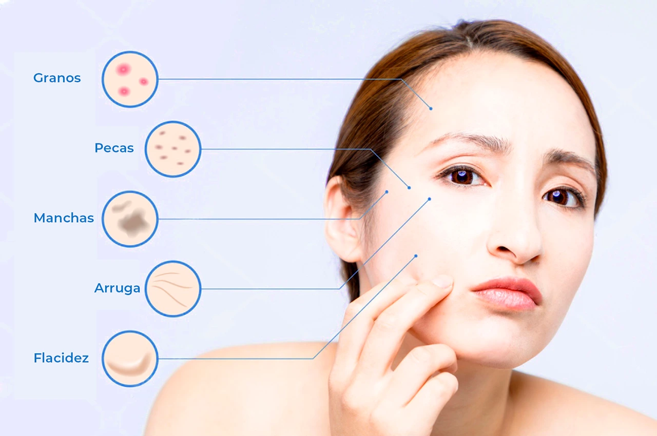 Imagen de una mujer tocándose la cara, donde se enlistan las diferentes condiciones que puede tratar un dermatólogo.