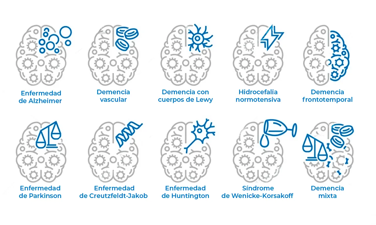 Ilustración que representa 10 tipos de demencia, que son las más comunes. Ilustración que representa 10 tipos de demencia, que son las más comunes.
