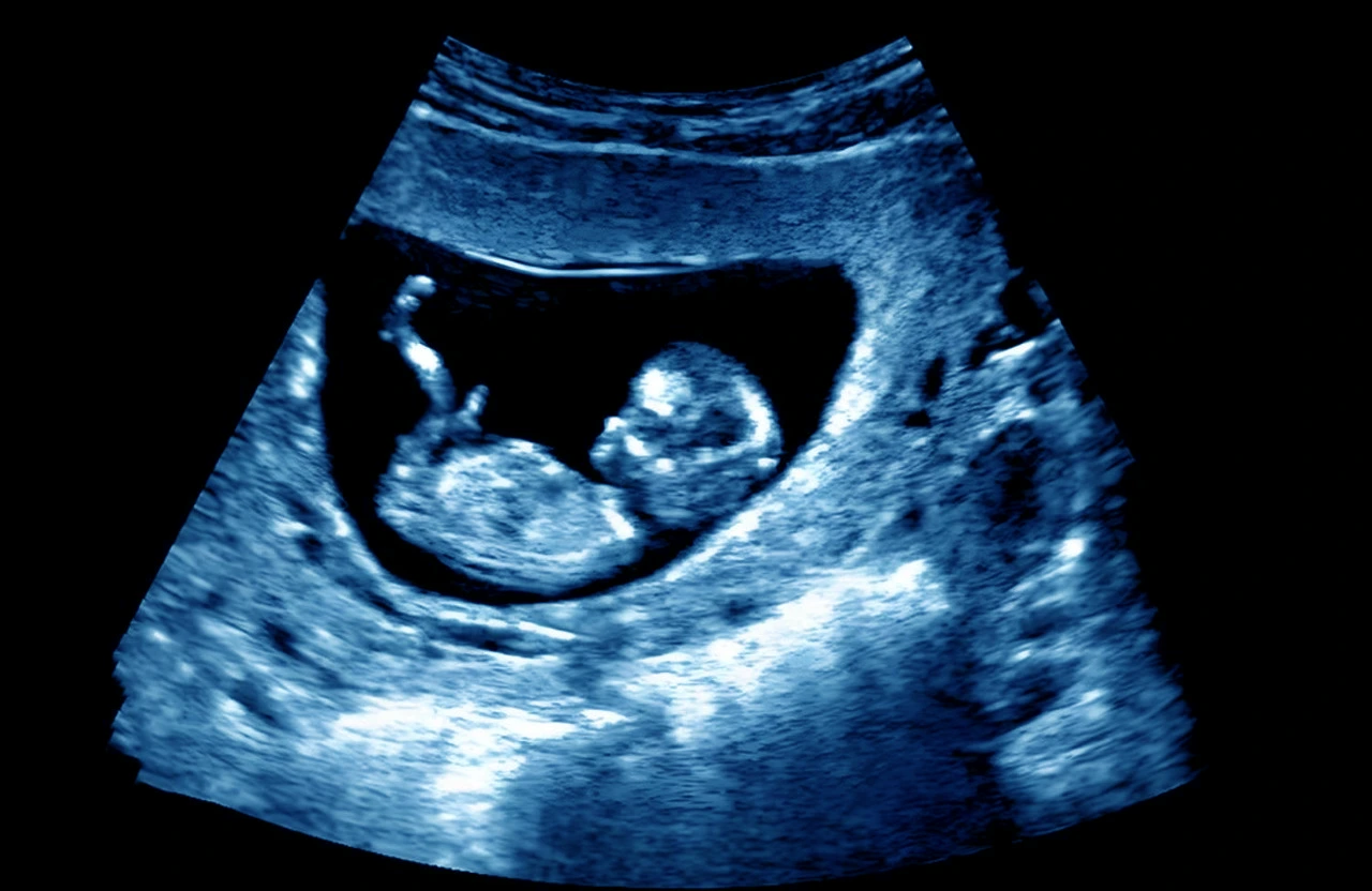 Ultrasonido realizado ante una sospecha de embarazo de alto riesgo, que forma parte de los estudios en esta etapa. Ultrasonido realizado ante una sospecha de embarazo de alto riesgo, que forma parte de los estudios en esta etapa.