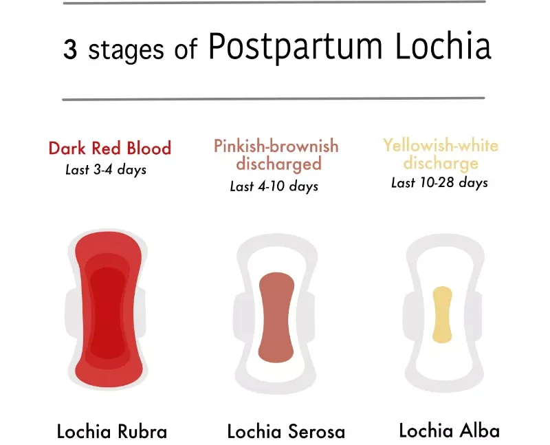 Ilustración de las etapas en el puerperio de los loquios y sangrado vaginal hasta su desaparición. Ilustración de las etapas en el puerperio de los loquios y sangrado vaginal hasta su desaparición.