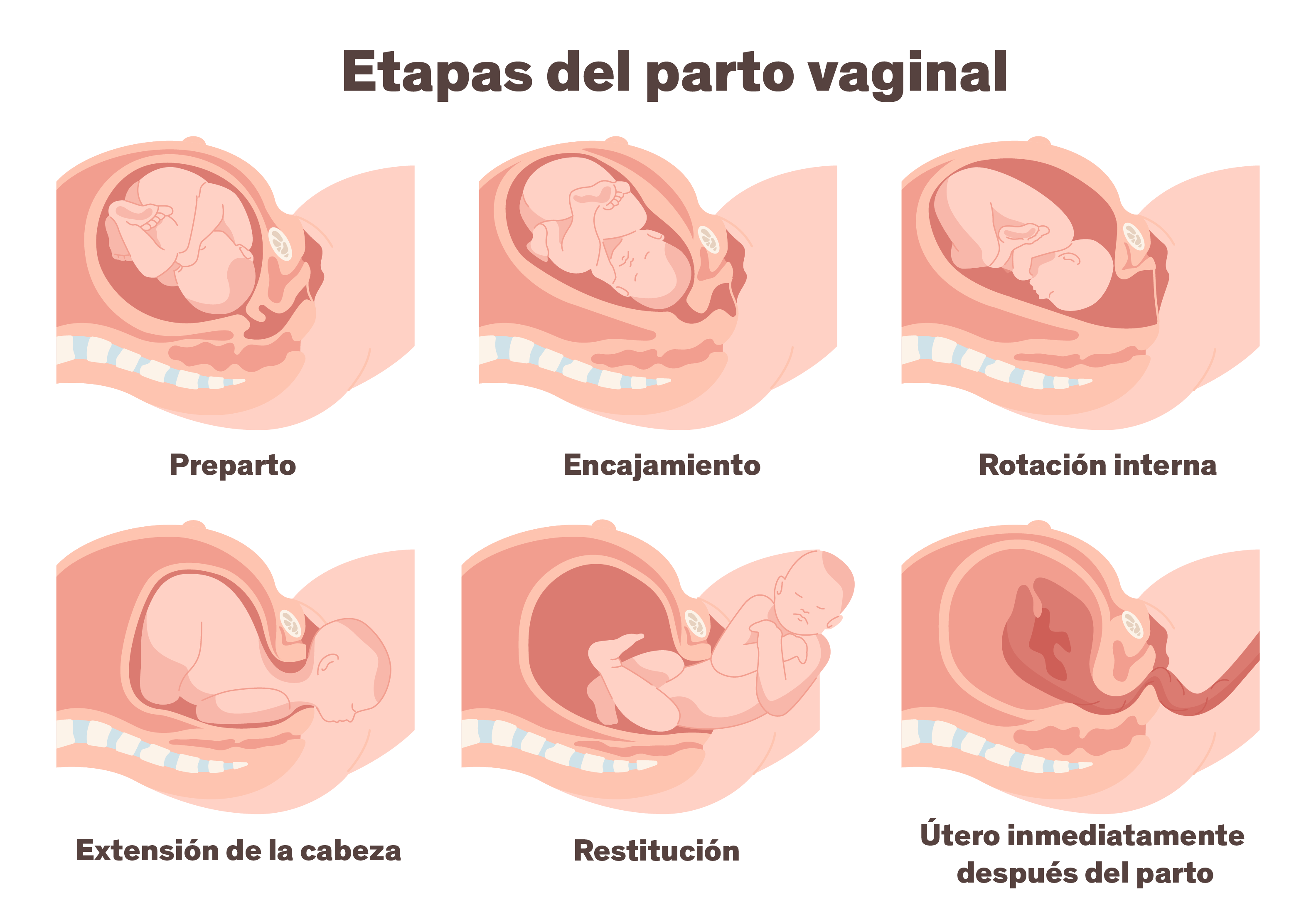 Ilustración que presenta durante el trabajo de parto, las diferentes etapas para el parto vaginal.