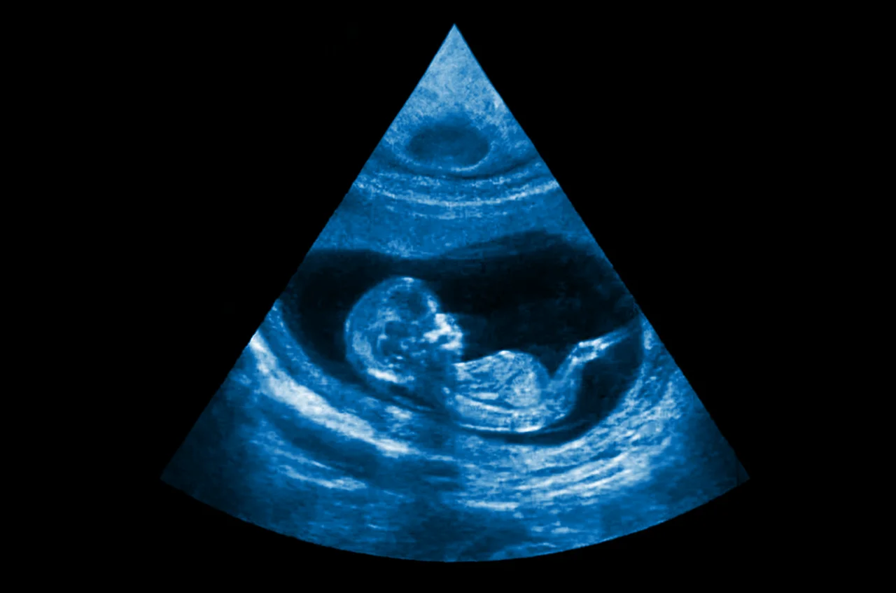 Ultrasonido realizado como estudio frecuente en el embarazo, en donde se da seguimiento al crecimiento del embrión y posteriormente del bebé. Ultrasonido realizado como estudio frecuente en el embarazo, en donde se da seguimiento al crecimiento del embrión y posteriormente del bebé.