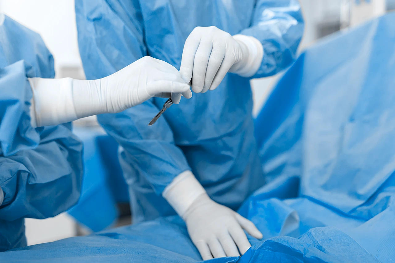 Foto de un médico pasando un bisturí a otro médico, una de las diferencias entre la laparoscopia vs abierta. Foto de un médico pasando un bisturí a otro médico, una de las diferencias entre la laparoscopia vs abierta.