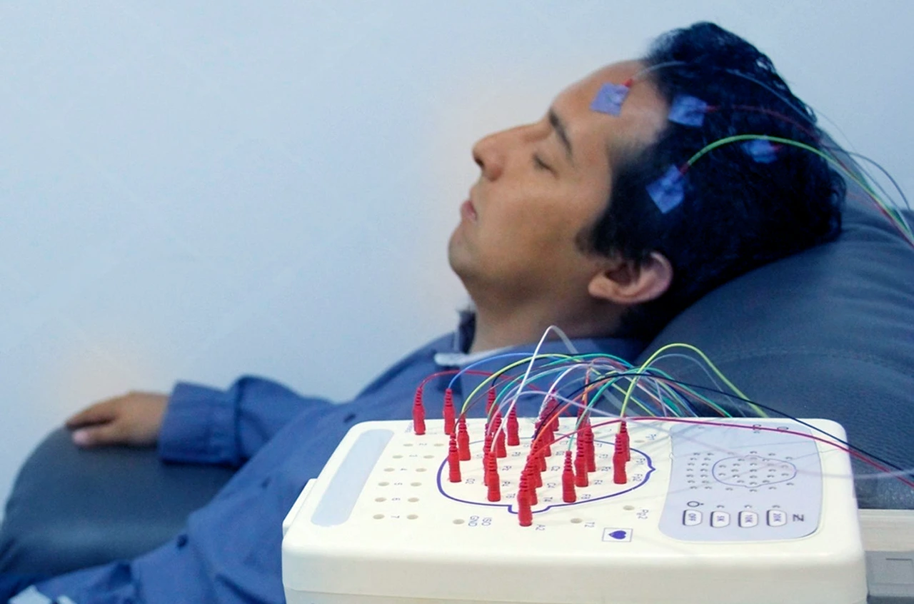 Electroencefalograma realizado a un paciente para identificar cuál de los tipos de epilepsia es el que ha desarrollado.