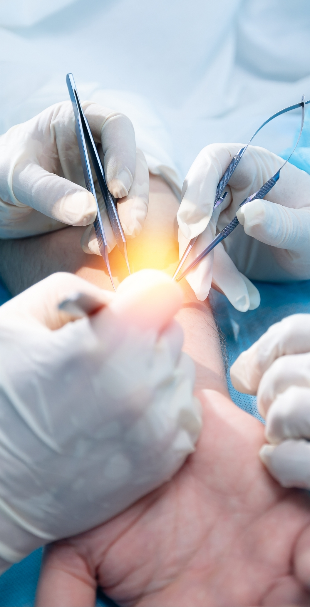 especializados en cirugia de mano especializados en cirugia de mano