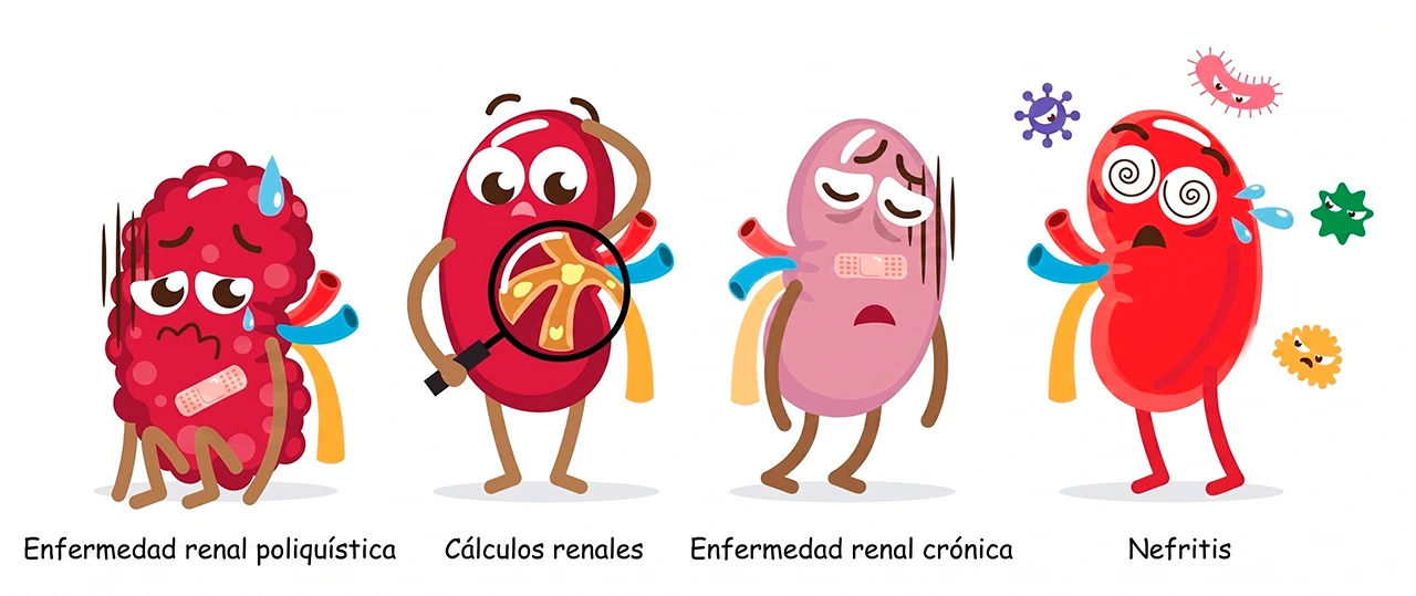 Ilustración de varios riñones representando las diferentes enfermedades que un nefrólogo puede tratar.