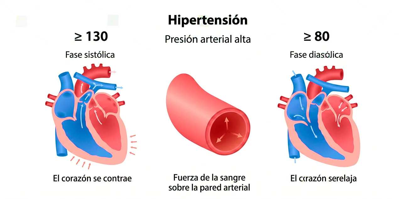 Ilustración que demuestra cómo surgen los síntomas de la hipertensión arterial, al explicar los rangos donde inicia.