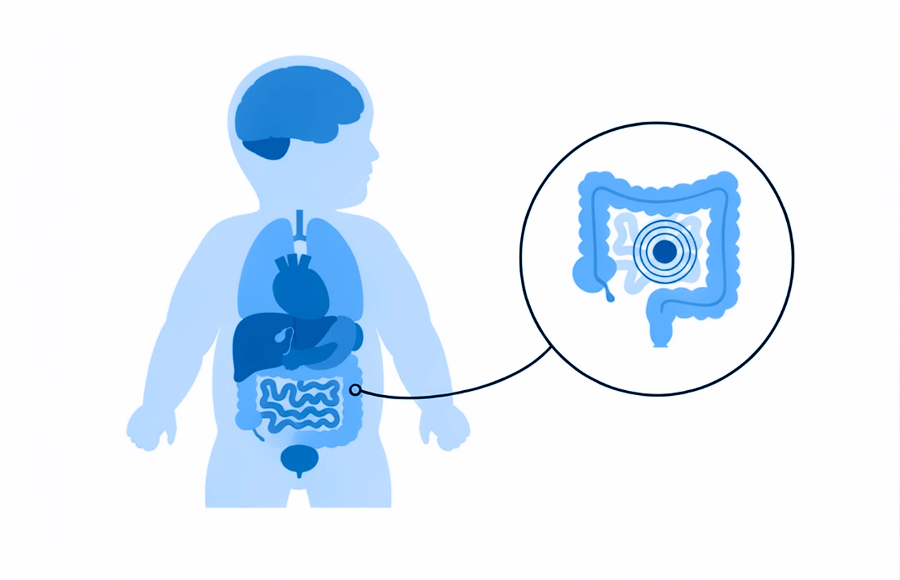 Silueta de un niño en donde se visualiza el intestino y otras zonas abdominales para abordar el vómito y diarrea en niños.