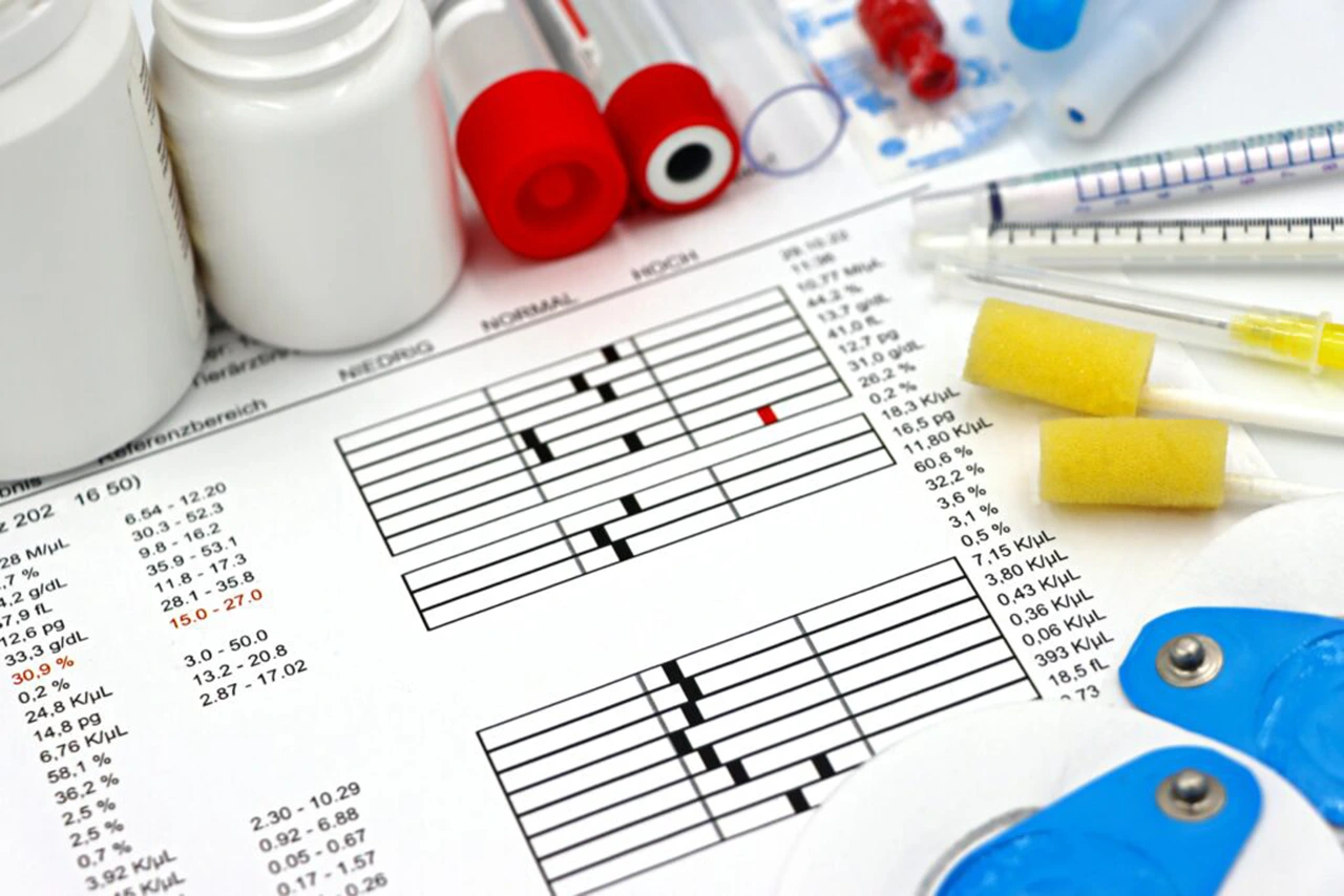 Hoja impresa con los resultados de un análisis de sangre, a su alrededor hay diversos equipos utilizados para llegar a esto. Hoja impresa con los resultados de un análisis de sangre, a su alrededor hay diversos equipos utilizados para llegar a esto.