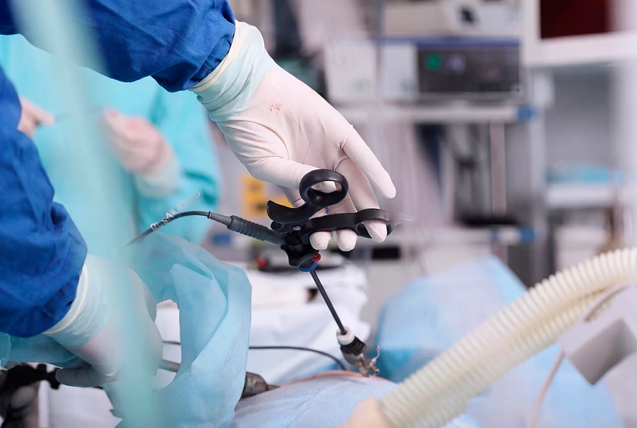 Realización de una laparoscopia, que se utiliza para tratar la hernia inguinal directa e indirecta.