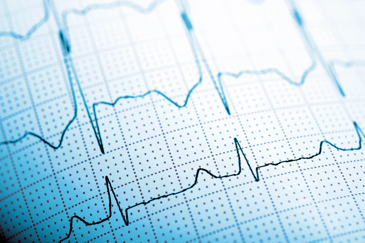 Electrocardiograma realizado en una prueba de esfuerzo, que forma parte de los estudios para cuidar la salud cardiovascular.