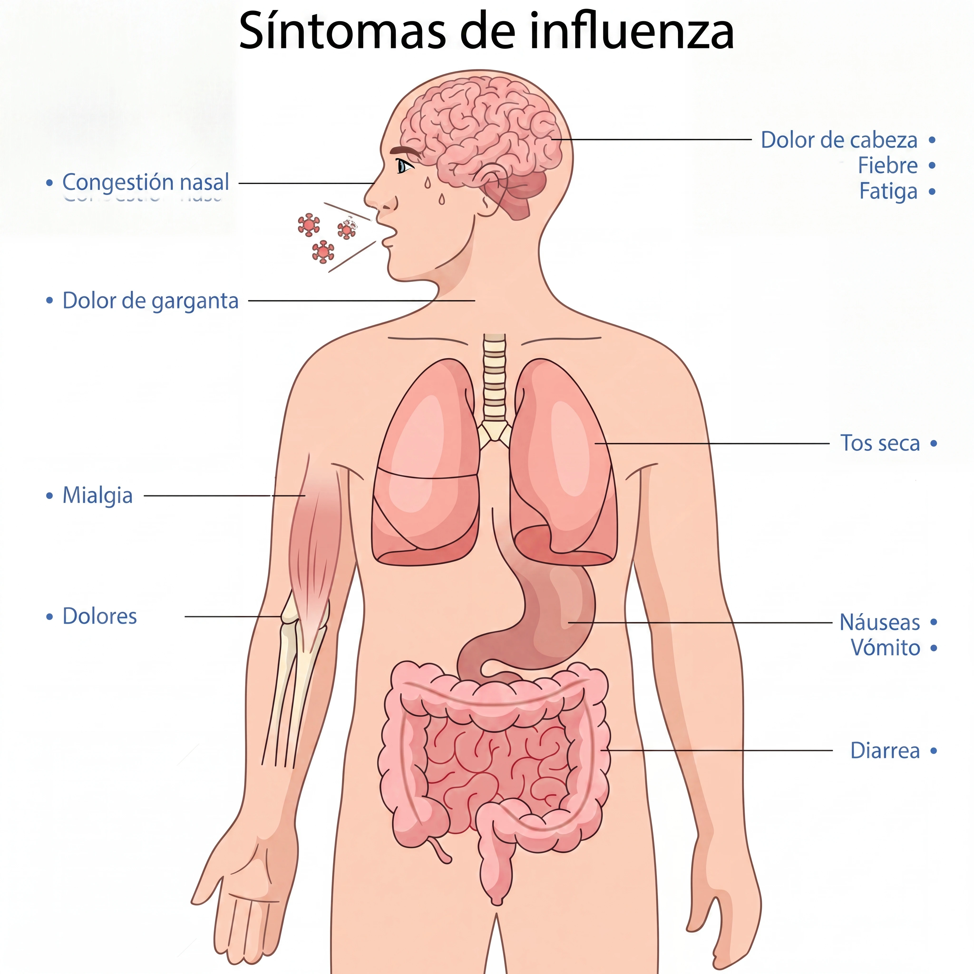 Ilustración que ejemplifica los síntomas de la influenza que se pueden presentar en el cuerpo. Ilustración que ejemplifica los síntomas de la influenza que se pueden presentar en el cuerpo.