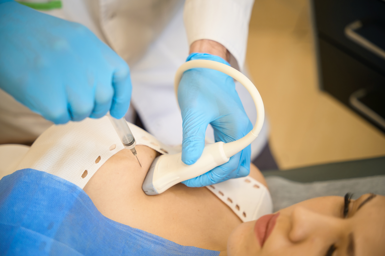 Muestra de tejido y análisis patológico para el diagnóstico de cáncer de mama Muestra de tejido y análisis patológico para el diagnóstico de cáncer de mama
