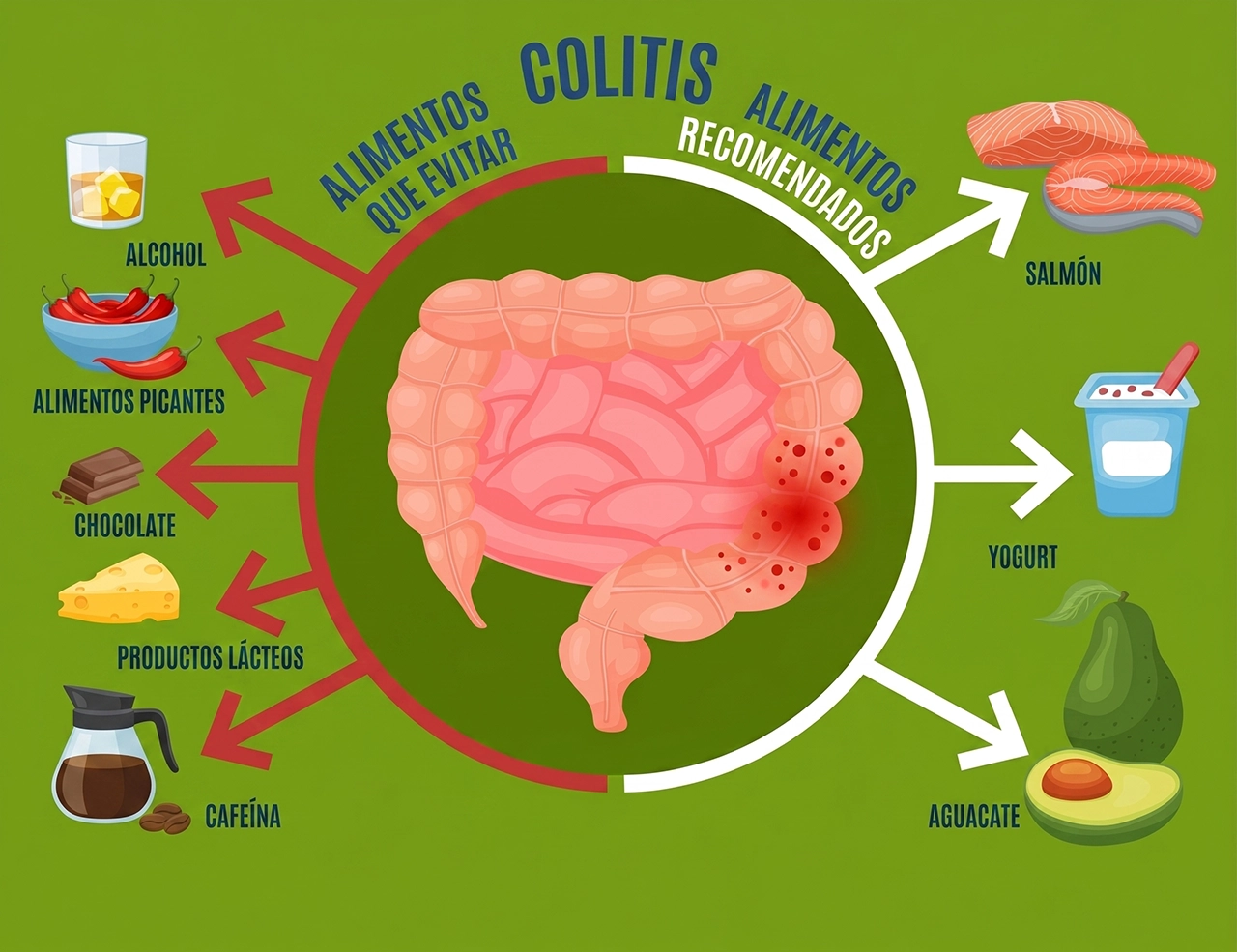 Ilustración que indica cuáles alimentos sirven para una dieta antiinflamatoria y cuales no para personas con colitis.