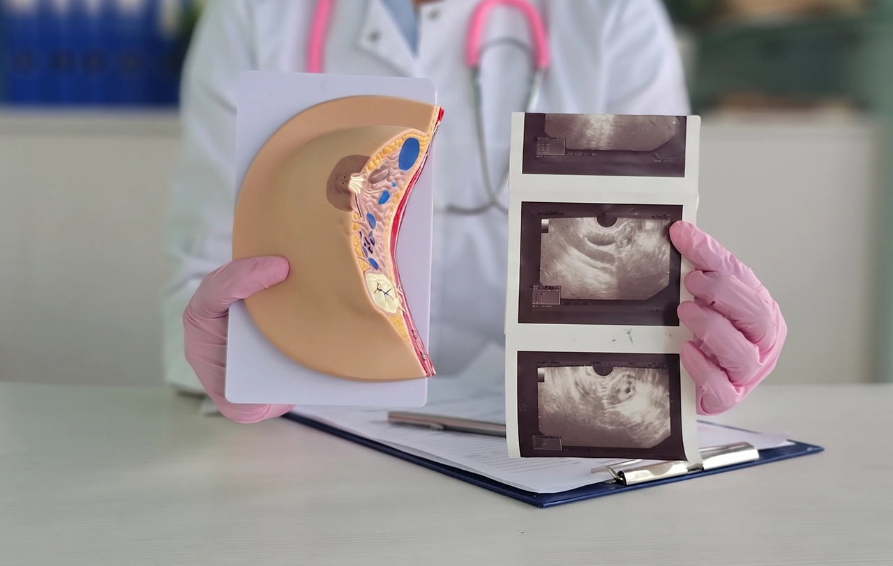 Especialista sosteniendo las impresiones de una ecografía mamaria como parte del método diagnóstico de la mastopatía fibroquística.