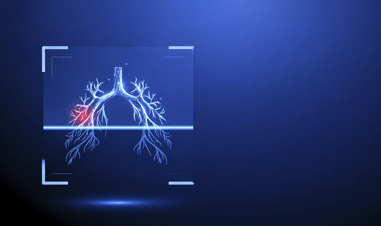 Diagnóstico de cáncer: estudios recomendados para la detección temprana
