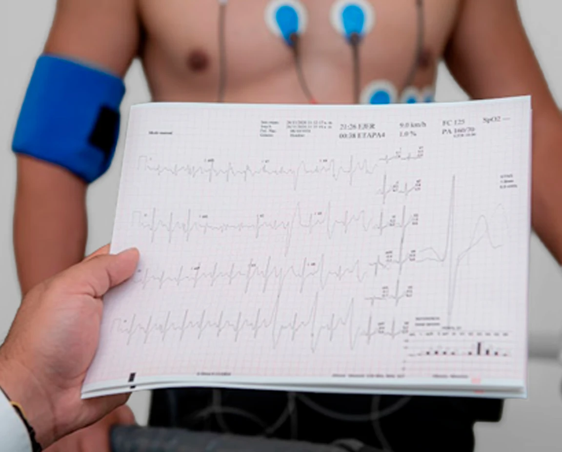 Segunda opinión cardiovascular